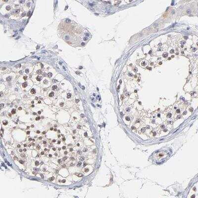 Immunohistochemistry-Paraffin: SMARCA1 Antibody [NBP1-83087] - Staining of human testis shows moderate nuclear positivity in cells in seminiferus ducts.