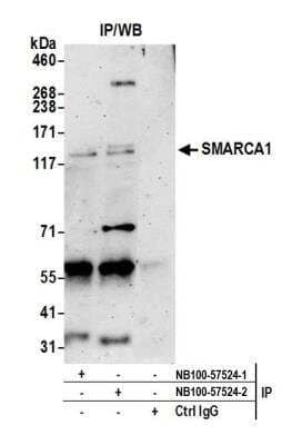 Immunoprecipitation: SMARCA1 Antibody [NB100-57524] - Detection of human SMARCA1 by western blot of immunoprecipitates. Samples: Whole cell lysate (0.5 or 1.0 mg per IP reaction; 20% of IP loaded) from HeLa cells prepared using NETN lysis buffer. Antibodies: Affinity purified rabbit anti-SMARCA1 antibody NB100-57524 (lot 2) used for IP at 6 ug per reaction. SMARCA1 was also immunoprecipitated by a previous lot of this antibody (lot 1). For blotting immunoprecipitated SMARCA1, NB100-57524 was used at 1 ug/ml. Detection: Chemiluminescence with an exposure time of 3 minutes.