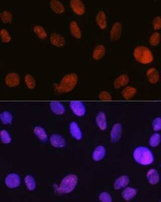 Immunocytochemistry/Immunofluorescence: SMARCA5/SNF2H Antibody (6H8I7) [NBP3-16216] - Immunofluorescence analysis of C6 cells using SMARCA5/SMARCA5/SNF2H Rabbit mAb (NBP3-16216) at dilution of 1:100 (40x lens). Blue: DAPI for nuclear staining.