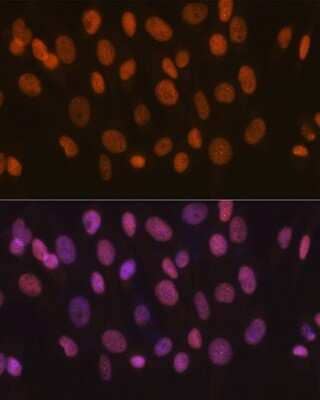 Immunocytochemistry/Immunofluorescence: SMARCA5/SNF2H Antibody (6H8I7) [NBP3-16216] - Immunofluorescence analysis of NIH-3T3 cells using SMARCA5/SMARCA5/SNF2H Rabbit mAb (NBP3-16216) at dilution of 1:100 (40x lens). Blue: DAPI for nuclear staining.