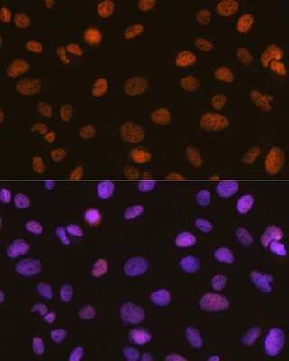 Immunocytochemistry/Immunofluorescence: SMARCA5/SNF2H Antibody (6H8I7) [NBP3-16216] - Immunofluorescence analysis of U-2 OS cells using SMARCA5/SMARCA5/SNF2H Rabbit mAb (NBP3-16216) at dilution of 1:100 (40x lens). Blue: DAPI for nuclear staining.