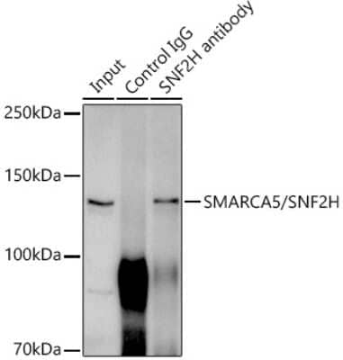 Immunoprecipitation: SMARCA5/SNF2H Antibody (6H8I7) [NBP3-16216] - Immunoprecipitation analysis of 300ug extracts of HeLa cells using 3ug SMARCA5/SNF2H antibody (NBP3-16216). Western blot was performed from the immunoprecipitate using SMARCA5/SNF2H antibody (NBP3-16216) at a dilition of 1:1000.