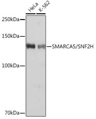 Western Blot: SMARCA5/SNF2H Antibody (6H8I7) [NBP3-16216] - Western blot analysis of extracts of various cell lines, using SMARCA5/SMARCA5/SNF2H Rabbit mAb (NBP3-16216) at 1:1000 dilution. Secondary antibody: HRP Goat Anti-Rabbit IgG (H+L) at 1:10000 dilution. Lysates/proteins: 25ug per lane. Blocking buffer: 3% nonfat dry milk in TBST. Detection: ECL Basic Kit. Exposure time: 1s.