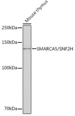 Western Blot: SMARCA5/SNF2H Antibody (6H8I7) [NBP3-16216] - Western blot analysis of extracts of Mouse thymus, using SMARCA5/SMARCA5/SNF2H Rabbit mAb (NBP3-16216) at 1:1000 dilution. Secondary antibody: HRP Goat Anti-Rabbit IgG (H+L) at 1:10000 dilution. Lysates/proteins: 25ug per lane. Blocking buffer: 3% nonfat dry milk in TBST. Detection: ECL Basic Kit. Exposure time: 10s.