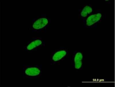 Immunocytochemistry/Immunofluorescence: SMARCA5/SNF2H Antibody [H00008467-B01P] - Analysis of purified antibody to SMARCA5 on HeLa cell. (antibody concentration 10 ug/ml)