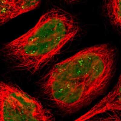 <b>Genetic Strategies Validation. </b>Immunocytochemistry/Immunofluorescence: SMARCA5/SNF2H Antibody [NBP1-89692] - Staining of human cell line A-431 shows localization to nucleus & nucleoli fibrillar center. Antibody staining is shown in green.