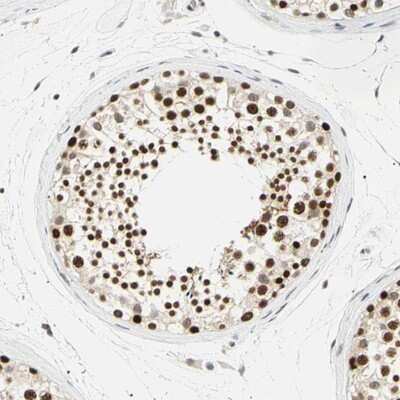 Immunohistochemistry-Paraffin: SMARCA5/SNF2H Antibody [NBP1-89692] - Staining of human testis shows strong nuclear positivity in cells in seminiferus ducts.