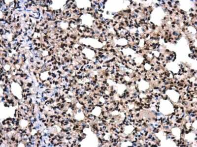 Immunohistochemistry-Paraffin: SMARCA5/SNF2H Antibody [NBP3-12952] - SMARCA5/SNF2H antibody detects SMARCA5/SNF2H protein at nucleus in rat lung by immunohistochemical analysis. Sample: Paraffin-embedded rat lung. SMARCA5/SNF2H antibody (NBP3-12952) diluted at 1:400. Antigen Retrieval: Citrate buffer, pH 6.0, 15 min