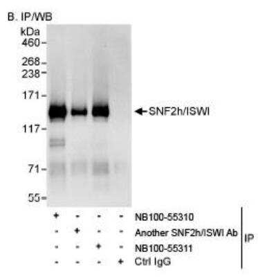 Immunoprecipitation: SMARCA5/SNF2H Antibody [NB100-55311] - Detection of Human SNF2h/ISWI by Western Blot of  Immunoprecipitates. Samples:  Whole cell lysate (1 mg for IP,  20% of IP loaded) from HeLa cells.  Antibodies: Affinity purified  rabbit anti-SNF2h/ISWI antibody NB100-55311 used for IP at 3  mcg/mg lysate. SNF2h/ISWI was also immunoprecipitated by another  rabbit anti-SNF2h/ISWI antibody and NB100-55310,  which recognize upstream epitopes.  Detection:  Chemiluminescence  with an exposure time of 10 seconds.