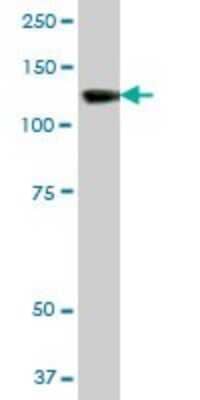 Western Blot: SMARCA5/SNF2H Antibody [H00008467-B01P] - Analysis of SMARCA5 expression in human liver.