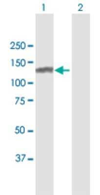 Western Blot: SMARCA5/SNF2H Antibody [H00008467-B01P] - Analysis of SMARCA5 expression in transfected 293T cell line by SMARCA5 polyclonal antibody.  Lane 1: SMARCA5 transfected lysate(115.72 KDa). Lane 2: Non-transfected lysate.