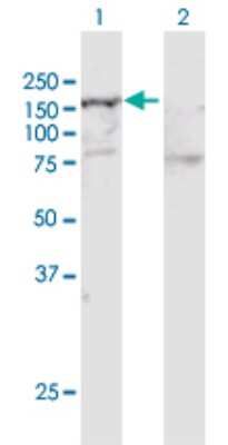 Western Blot: SMARCA5/SNF2H Antibody [H00008467-D01P] - Analysis of SMARCA5 expression in transfected 293T cell line by SMARCA5 polyclonal antibody.Lane 1: SMARCA5 transfected lysate(121.90 KDa).Lane 2: Non-transfected lysate.