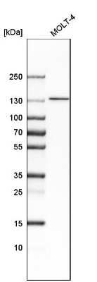 Western Blot: SMARCA5/SNF2H Antibody [NBP1-89692] - Analysis in human cell line MOLT-4.