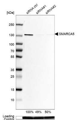 Western Blot: SMARCA5/SNF2H Antibody [NBP1-89692] - Analysis in Rh30 cells transfected with control siRNA, target specific siRNA probe #1 and #2, using Anti-SMARCA5 antibody. Remaining relative intensity is presented. Loading control: Anti-GAPDH.