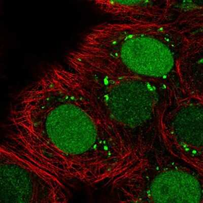 Immunocytochemistry/Immunofluorescence: SMARCA6 Antibody [NBP2-38986] - Staining of human cell line MCF7 shows localization to nucleus, the Golgi apparatus & vesicles. Antibody staining is shown in green.