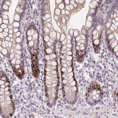 Immunohistochemistry-Paraffin: SMARCA6 Antibody [NBP2-38986] - Staining of human small intestine shows moderate nuclear positivity in glandular cells.