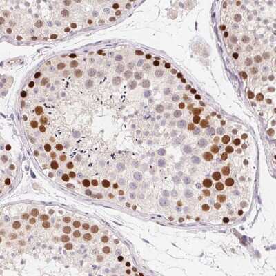 Immunohistochemistry-Paraffin: SMARCA6 Antibody [NBP2-38986] - Staining of human testis shows moderate to strong nuclear positivity in cells in seminiferous ducts.