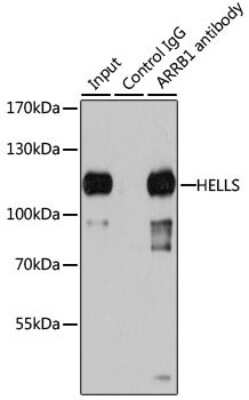 Immunoprecipitation: SMARCA6 Antibody [NBP3-03793] - Analysis of 200ug extracts of 293T cells using SMARCA6 antibody . Western blot was performed from the immunoprecipitate using this antibody.