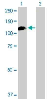 Western Blot: SMARCA6 Antibody [H00003070-D01P] - Analysis of HELLS expression in transfected 293T cell line by HELLS polyclonal antibody.Lane 1: HELLS transfected lysate(97.10 KDa).Lane 2: Non-transfected lysate.
