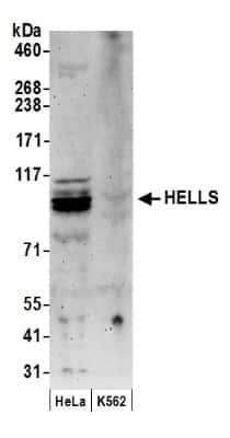 Western Blot: SMARCA6 Antibody [NB100-278] - Detection of Human HELLS by Western Blot. Samples: Whole cell lysate (50 ug) from HeLa and K562 cells prepared using NETN lysis buffer. Antibody: Affinity purified rabbit anti-HELLS antibody NB100-278 used for WB at 0.1 ug/ml. Detection: Chemiluminescence with an exposure time of 3 minutes.