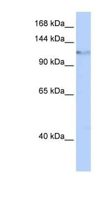 Western Blot: SMARCA6 Antibody [NBP1-57145] - HepG2 cell lysate, concentration 0.2-1 ug/ml.