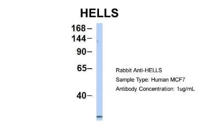 Western Blot: SMARCA6 Antibody [NBP1-57145] - MCF7, Antibody Dilution: 1.0 ug/ml HELLS is supported by BioGPS gene expression data to be expressed in MCF7.