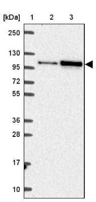 Western Blot: SMARCA6 Antibody [NBP2-38986] - Lane 1: Marker  [kDa] 250, 130, 95, 72, 55, 36, 28, 17, 10.  Lane 2: Human cell line RT-4.  Lane 3: Human cell line U-251MG