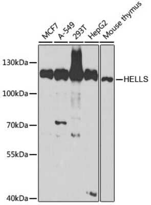 Western Blot: SMARCA6 Antibody [NBP3-03793] - Analysis of extracts of various cell lines, using SMARCA6 antibody at 1:1000 dilution. Secondary antibody: HRP Goat Anti-Rabbit IgG (H+L) at 1:10000 dilution. Lysates/proteins: 25ug per lane. Blocking buffer: 3% nonfat dry milk in TBST. Detection: ECL Basic Kit.