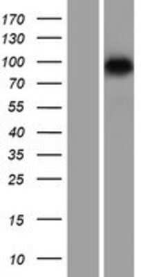 Western Blot: SMARCA6 Overexpression Lysate (Adult Normal) [NBL1-11502] Left-Empty vector transfected control cell lysate (HEK293 cell lysate); Right -Over-expression Lysate for SMARCA6.