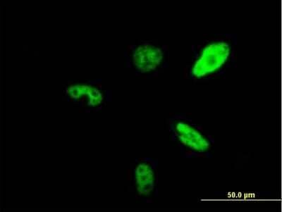 Immunocytochemistry/Immunofluorescence: SMARCAD1 Antibody [H00056916-B01P] - Analysis of purified antibody to SMARCAD1 on HeLa cell. (antibody concentration 10 ug/ml)