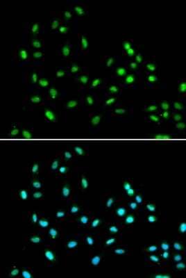 Immunocytochemistry/Immunofluorescence: SMARCAD1 Antibody [NBP2-94459] - Analysis of A549 cells using SMARCAD1 . Blue: DAPI for nuclear staining.