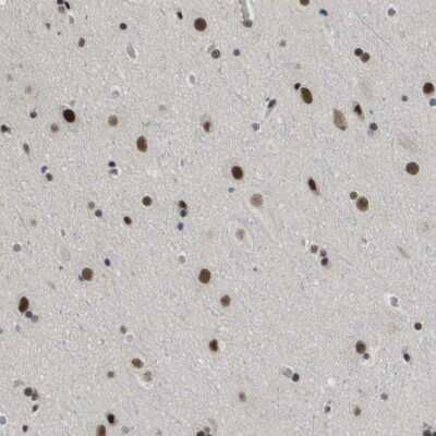 Immunohistochemistry-Paraffin: SMARCAD1 Antibody [NBP1-85023] - Staining of human cerebral cortex shows moderate to strong nuclear positivity in neurons.