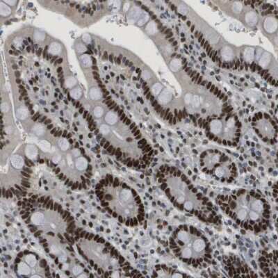 Immunohistochemistry-Paraffin: SMARCAD1 Antibody [NBP1-85023] - Staining of human duodenum shows strong nuclear positivity in glandular cells.