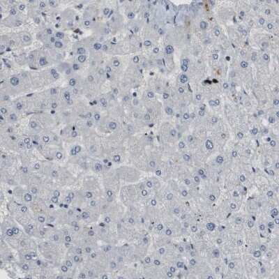 Immunohistochemistry-Paraffin: SMARCAD1 Antibody [NBP1-85023] - Staining of human liver shows no positivity in hepatocytes as expected.