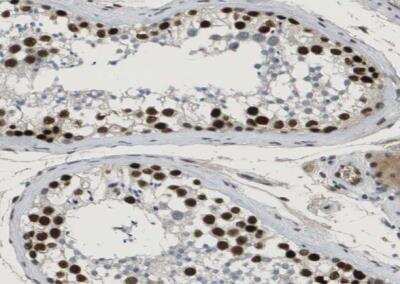 Immunohistochemistry-Paraffin: SMARCAD1 Antibody [NBP1-85023] - Staining of human testis shows strong nuclear positivity in cells in seminiferous ducts.