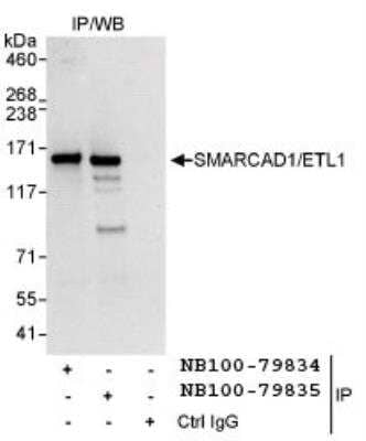 Immunoprecipitation: SMARCAD1 Antibody [NB100-79834] - Samples: Whole cell lysate (1 mg for IP,  20% of IP loaded) from HeLa cells. Antibodies: Affinity purified  rabbit anti-SMARCAD1/ETL1 antibody NB100-79834 used for IP at 3 mcg/mg lysate. SMARCAD1/ETL1 was also immunoprecipitated by rabbit anti-SMARCAD1/ETL1 antibody NB10-79835, which recognizes a downstream epitope. Detection: Chemiluminescence with an exposure time of 3 seconds.