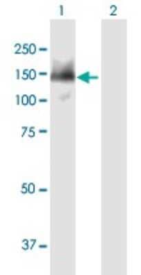 Western Blot: SMARCAD1 Antibody [H00056916-B01P] - Analysis of SMARCAD1 expression in transfected 293T cell line by SMARCAD1 polyclonal antibody.  Lane 1: SMARCAD1 transfected lysate(113.08 KDa). Lane 2: Non-transfected lysate.