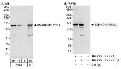 Western Blot: SMARCAD1 Antibody [NB100-79835] - Detection of Human and Mouse SMARCAD1/ETL1 on HeLa whole cell lysate using NB100-79835. SMARCAD1/ETL1 was also IPed by rabbit anti-  SMARCAD1/ETL1 antibody NB100-79834.