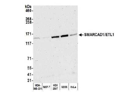 Western Blot: SMARCAD1 Antibody [NB100-79835] - Whole cell lysate (50 ug) from MDA-MB-231,MCF-7, HEK293T, U2OS, and HeLa cells prepared using NETN lysis buffer. Antibody: Affinity purified rabbit anti-SMARCAD1/ETL1 antibody used for WB at 0.04 ug/ml. Detection: Chemiluminescencewith an exposure time of 3 minutes.