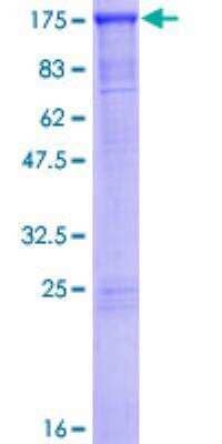 SDS-PAGE Recombinant Human SMARCAD1 GST (N-Term) Protein