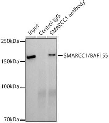 Immunoprecipitation: SMARCC1 Antibody (1R7I6) [NBP3-16367] - Immunoprecipitation analysis of 300ug extracts of HepG2 cells using 3ug SMARCC1 antibody (NBP3-16367). Western blot was performed from the immunoprecipitate using SMARCC1 antibody (NBP3-16367) at a dilition of 1:500.