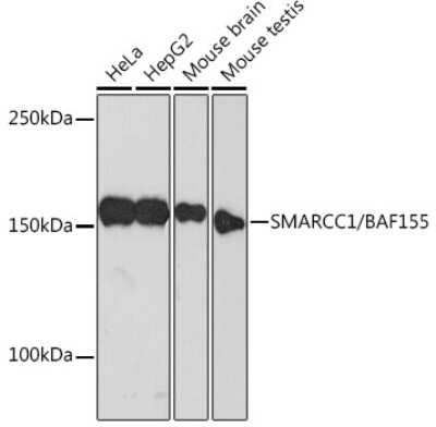 Western Blot: SMARCC1 Antibody (1R7I6) [NBP3-16367] - Western blot analysis of extracts of various cell lines, using SMARCC1 Rabbit mAb (NBP3-16367) at 1:500 dilution. Secondary antibody: HRP Goat Anti-Rabbit IgG (H+L) at 1:10000 dilution. Lysates/proteins: 25ug per lane. Blocking buffer: 3% nonfat dry milk in TBST. Detection: ECL Basic Kit. Exposure time: 3min.