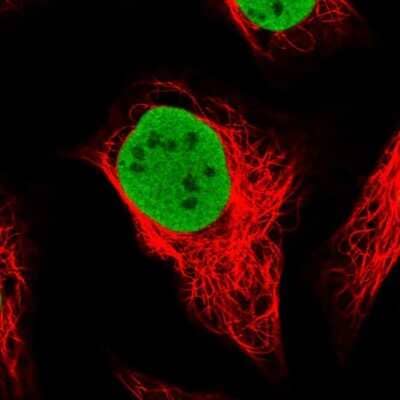 Immunocytochemistry/Immunofluorescence: SMARCC1 Antibody [NBP1-88720] - Immunofluorescent staining of human cell line U-2 OS shows localization to nucleoplasm.