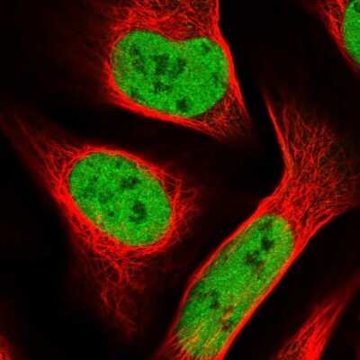 Immunocytochemistry/Immunofluorescence: SMARCC1 Antibody [NBP1-88721] - Immunofluorescent staining of human cell line U-2 OS shows localization to nucleoplasm.