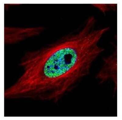 Immunocytochemistry/Immunofluorescence: SMARCC1 Antibody [NBP2-20415] - Confocal immunofluorescence analysis of paraformaldehyde-fixed HeLa, using SMARCC1 antibody (Green) at 1:500 dilution. Alpha-tubulin filaments are labeled with Alpha-tubulin antibody (Red) at 1:2000.