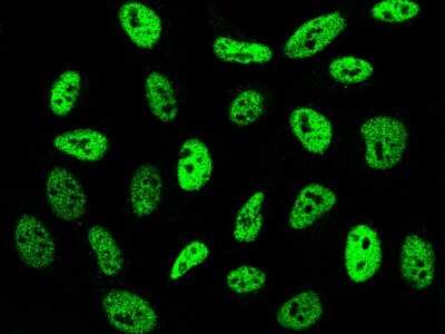 Immunocytochemistry/Immunofluorescence: SMARCC1 Antibody [NBP2-98777] - Immunofluorescence staining of SMARCC1 in HeLa cells. Cells were fixed with 4% PFA, permeabilzed with 0.3% Triton X-100 in PBS, blocked with 10% serum, and incubated with rabbit anti-human SMARCC1 polyclonal antibody (dilution ratio 1:1000) at 4C overnight. Then cells were stained with the Alexa Fluor$488-conjugated Goat Anti-rabbit IgG secondary antibody (green). Positive staining was localized to nucleus.