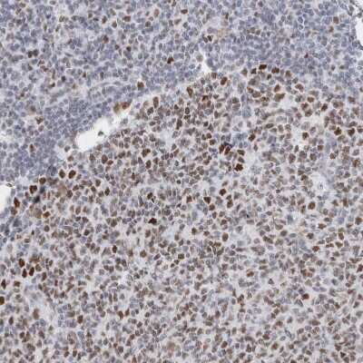 Immunohistochemistry-Paraffin: SMARCC1 Antibody [NBP1-88720] - Staining of human tonsil shows moderate to strong nuclear positivity in germinal center cells.