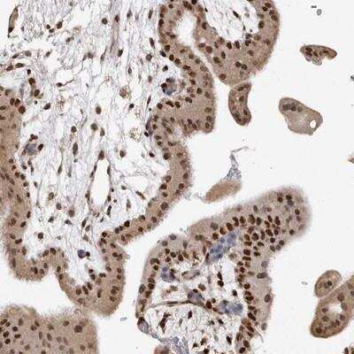 Immunohistochemistry: SMARCC1 Antibody [NBP1-88721] - Staining of human placenta shows distinct nuclear positivity in trophoblastic cells.