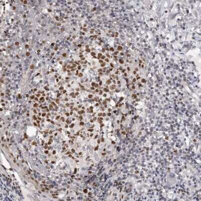 Immunohistochemistry: SMARCC1 Antibody [NBP1-88721] - Staining of human tonsil shows strong nuclear positivity in germinal center cells.