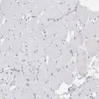 Immunohistochemistry-Paraffin: SMARCC1 Antibody [NBP1-88720] - Staining of human skeletal muscle shows low expression as expected.